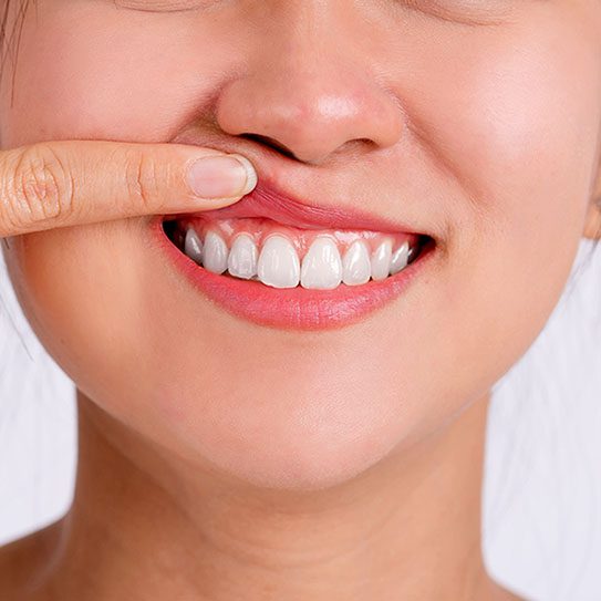 Viera Dental Arts | Dentist in Melbourne FL -