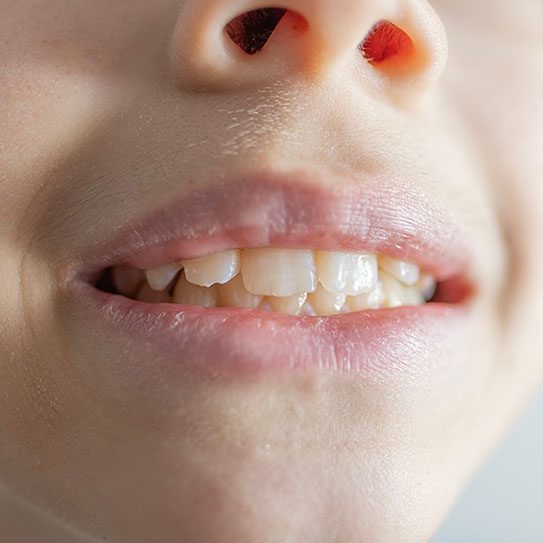 Viera Dental Arts | Dentist in Melbourne FL -