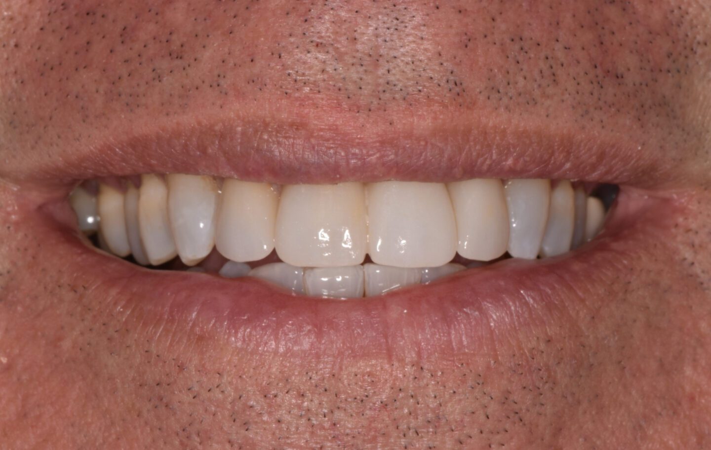 Viera Dental Arts | Dentist in Melbourne FL -