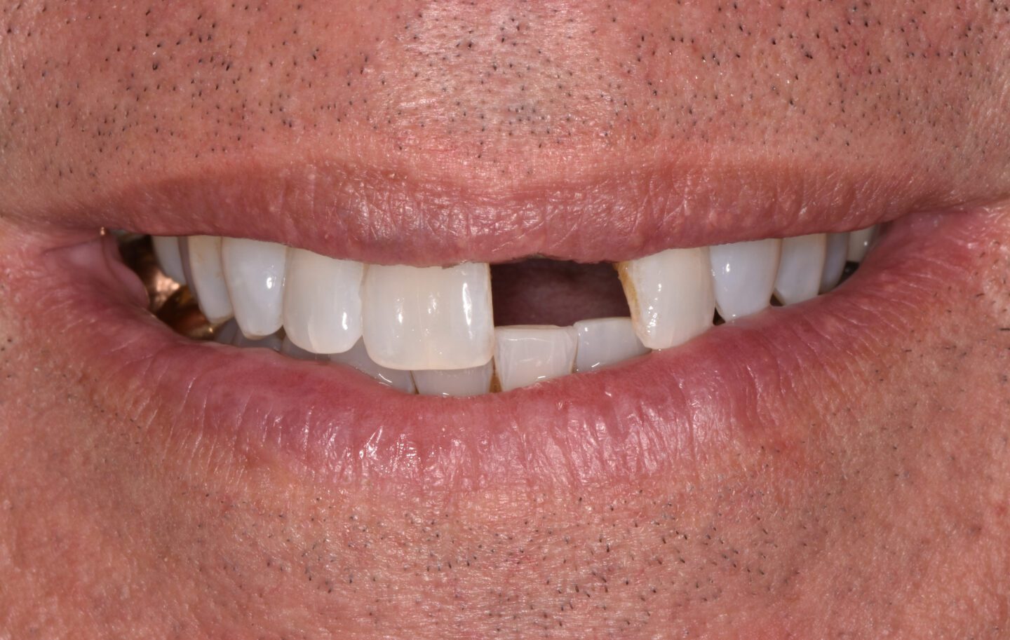 Viera Dental Arts | Dentist in Melbourne FL -