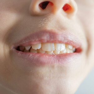 Viera Dental Arts | Dentist in Melbourne FL -