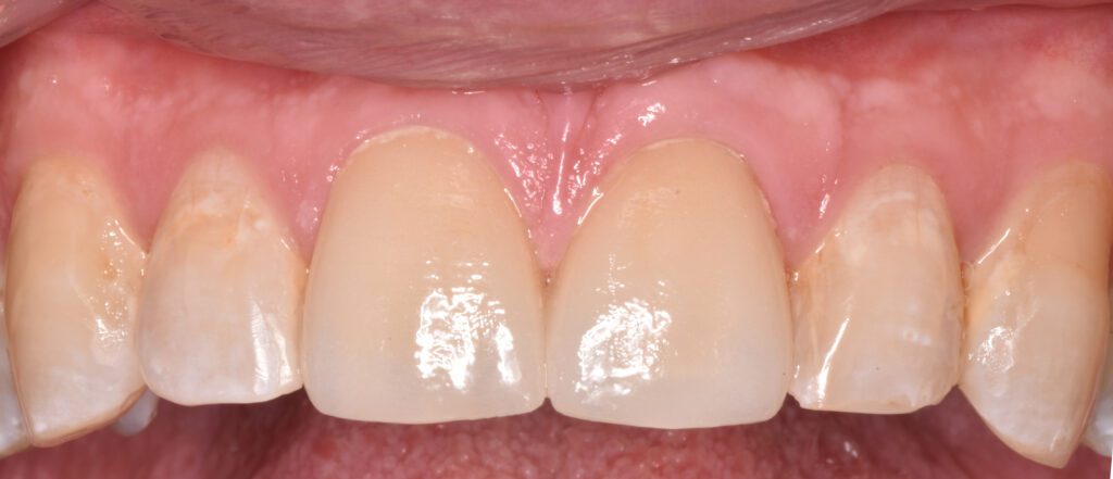 Viera Dental Arts | Dentist in Melbourne FL -