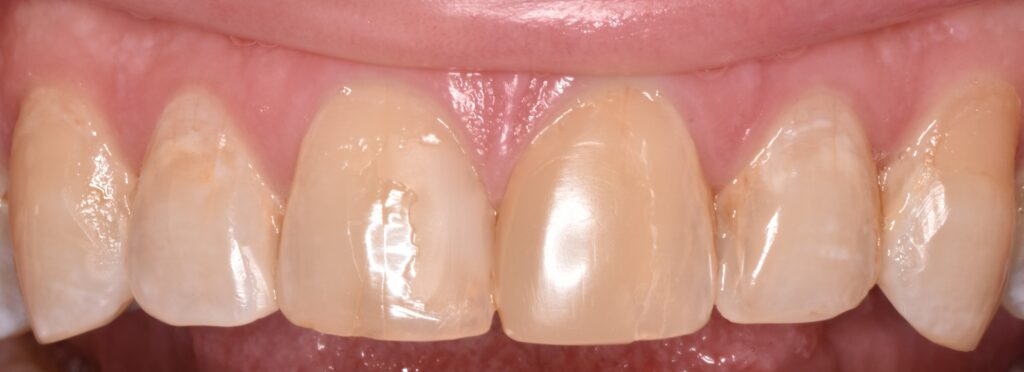 Viera Dental Arts | Dentist in Melbourne FL -