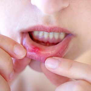Dental Blog - Viera Dental Arts | Dentist in Melbourne FL - Viera Dental Arts | Dentist in Melbourne FL -
