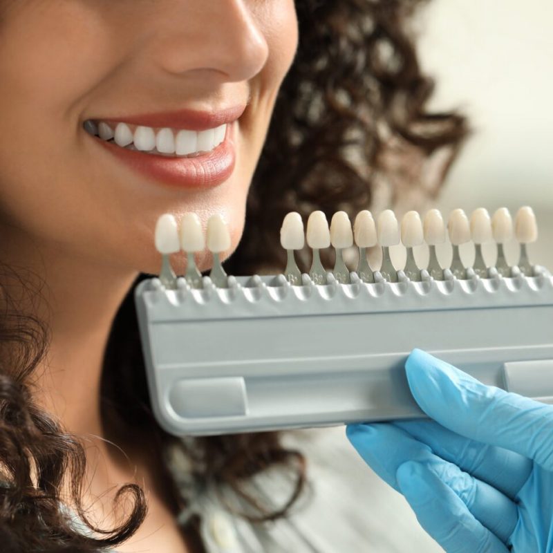 Doctor checking young woman's teeth color in clinic, closeup. Dental veneers