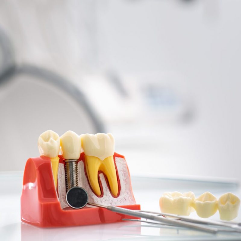 Stomatology concept. Detailed tooth model showcases the layers of enamel and dentin in a bright dental office equipped for patient care