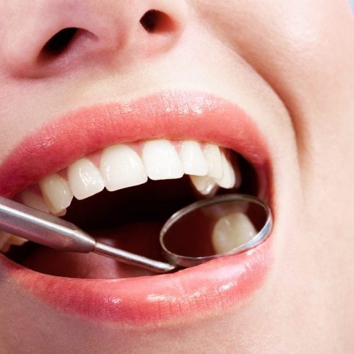 Close-up of open mouth during oral checkup at the dentist’s