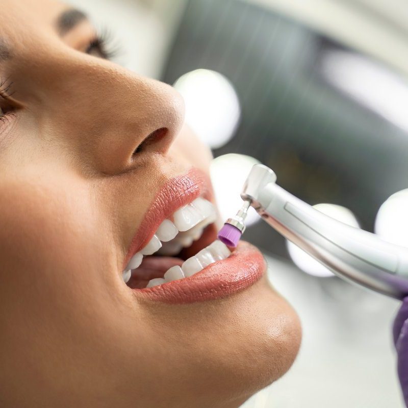Closeup , teeth polishing procedure , closeup of beautiful young woman face
