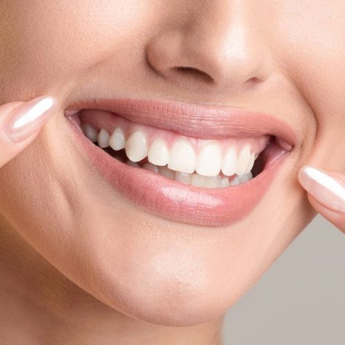 Unrecognizable Girl Pointing At Smile, Beige Background, Panorama Toothcare. Unrecognizable Smiling Girl Pointing At Smile And Healthy White Teeth Posing On Beige Studio Background. Panorama, Cropped